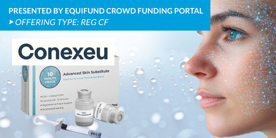 Conexeu Offering
